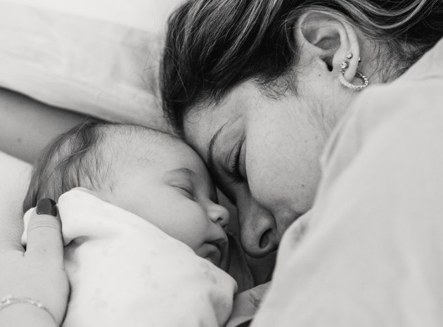 <strong>Sauskelnių dermatitas. Ką būtina žinoti tėveliams?</strong>